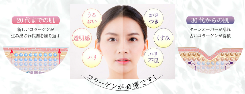 VC200�z���w�v���`�iVC�Z�����x���T�C�g